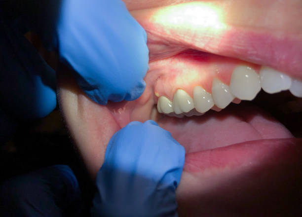 Best Emergency TMJ Treatment in Cassopolis, MI